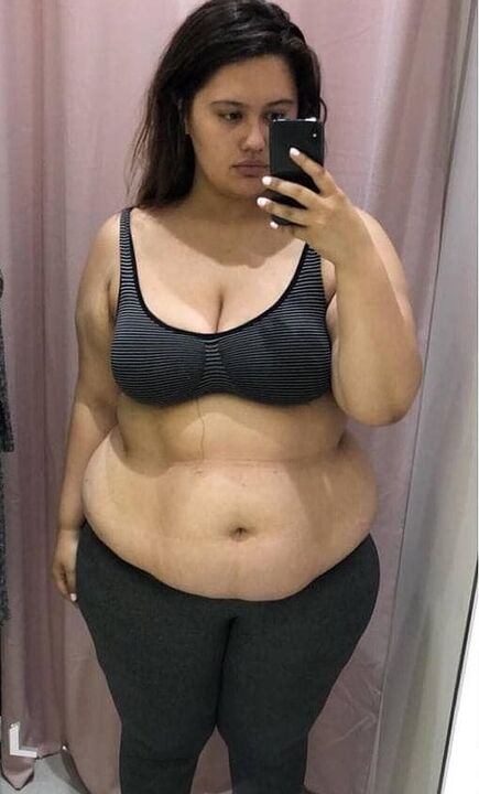 ฉันเกลียดร่างกายของตัวเองเพราะน้ำหนักส่วนเกิน